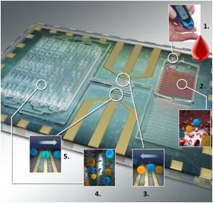  New Biochip Offers Specific Leukocyte Counting for HIV Diagnosis