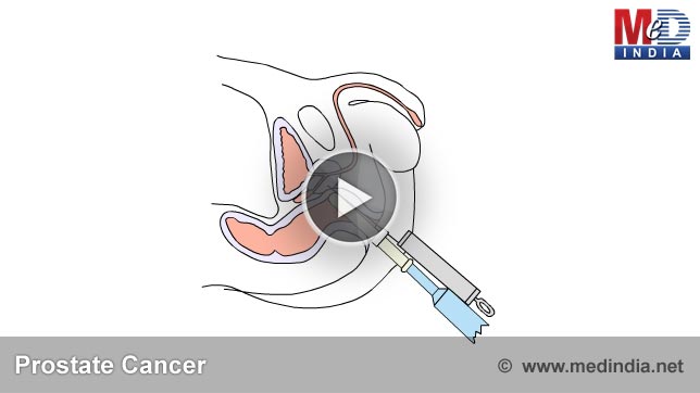 Animation Of Cancer