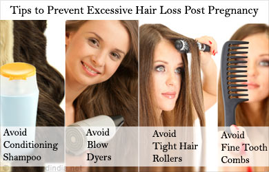 Tip to Prevent Excessive Hair Loss