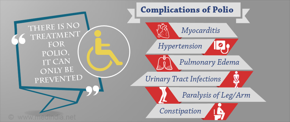 Poliomyelitis - Complications of Polio Symptoms