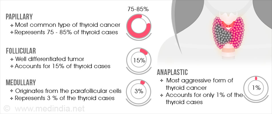 Thyroid Cancer Types Spread