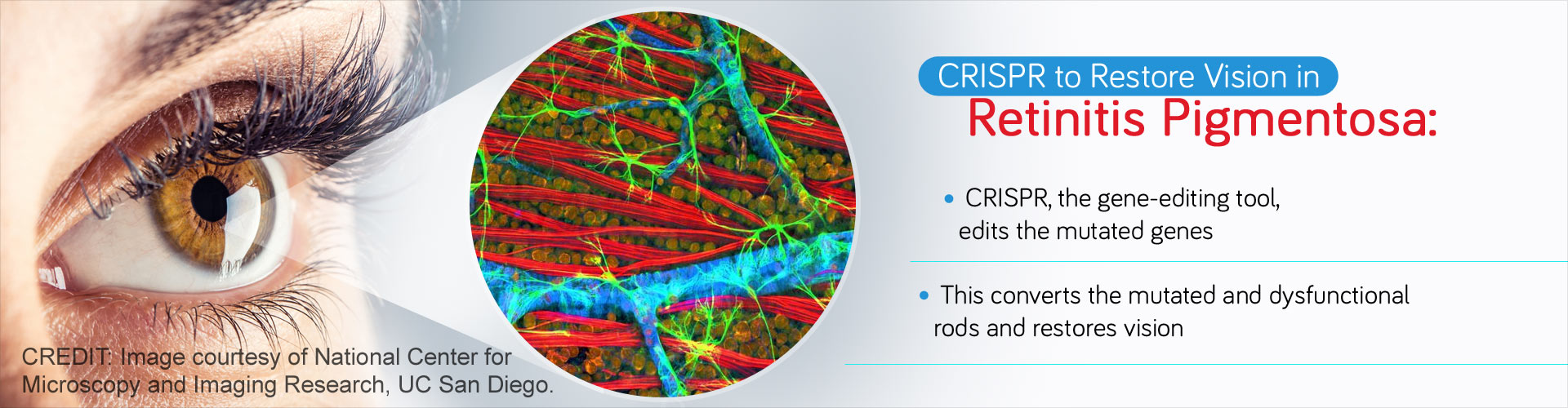 Gene Therapy To Reverse Retinitis Pigmentosa, Restore Vision