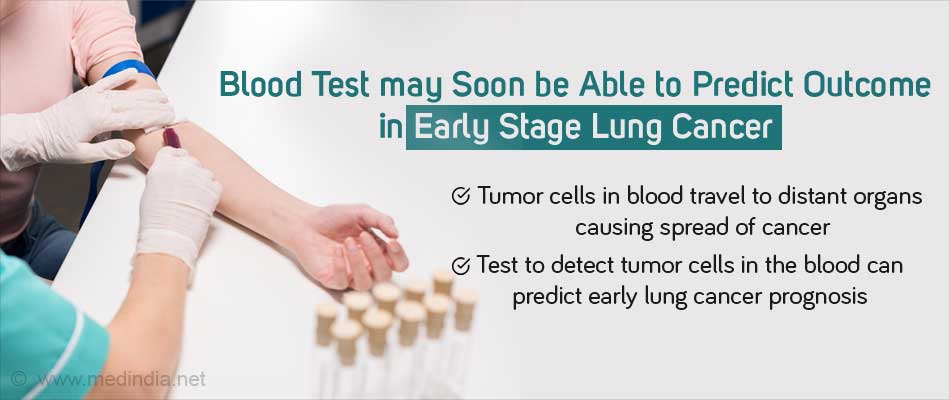 Detection of Tumor Cells In Blood May Indicate Prognosis