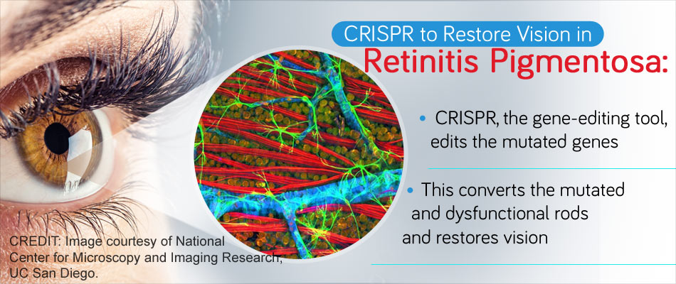 Gene Therapy To Reverse Retinitis Pigmentosa Restore Vision