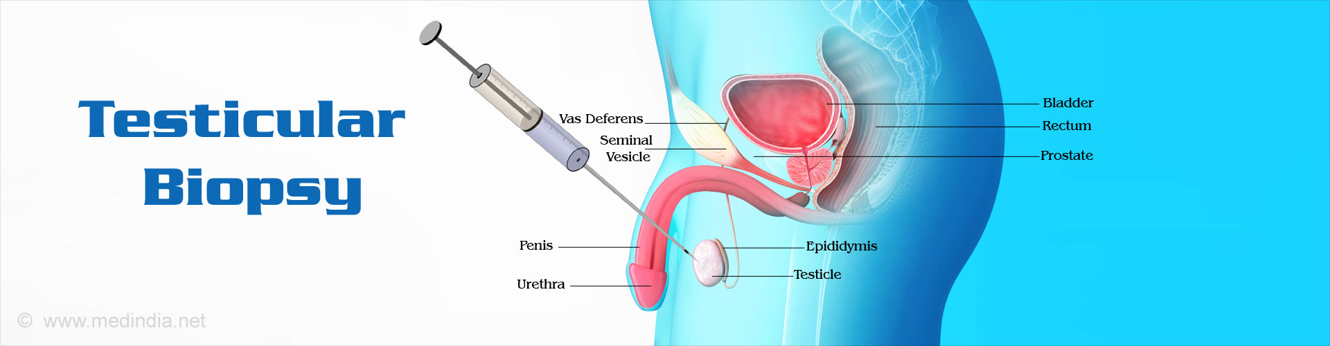 Testicular Biopsy Types Procedure Precautions Risks Results