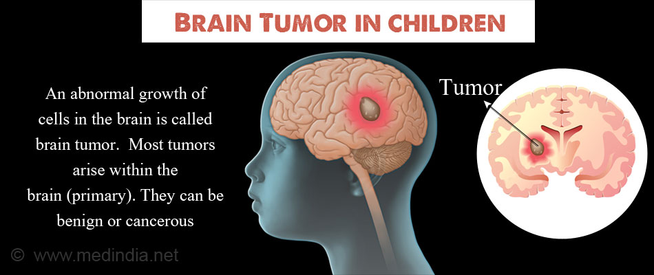 Brain Tumor In Children Types Causes Symptoms Diagnosis And Treatment