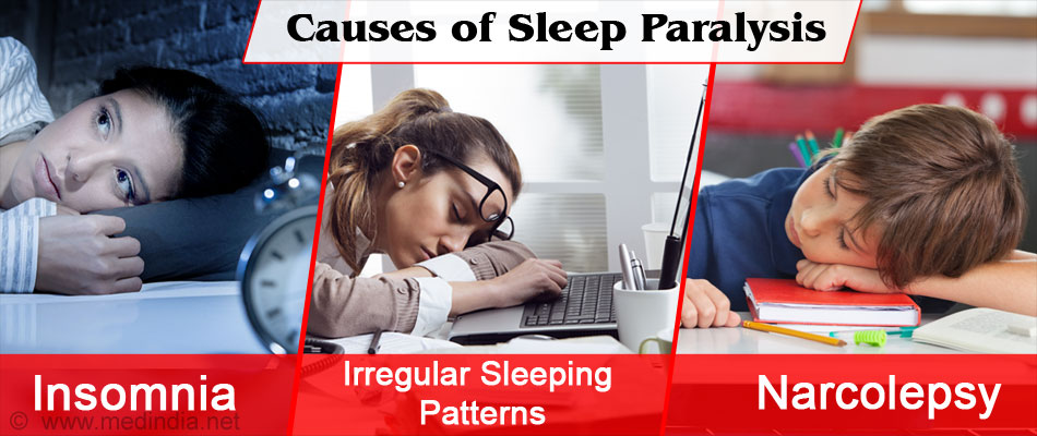 Sleep Paralysis Types Causes Symptoms Risk Factors Diagnosis Treatment And Prevention