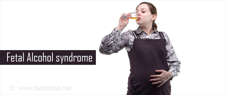 Fetal Alcohol Syndrome Fas Causes Symptoms Diagnosis Treatment Prevention 9008