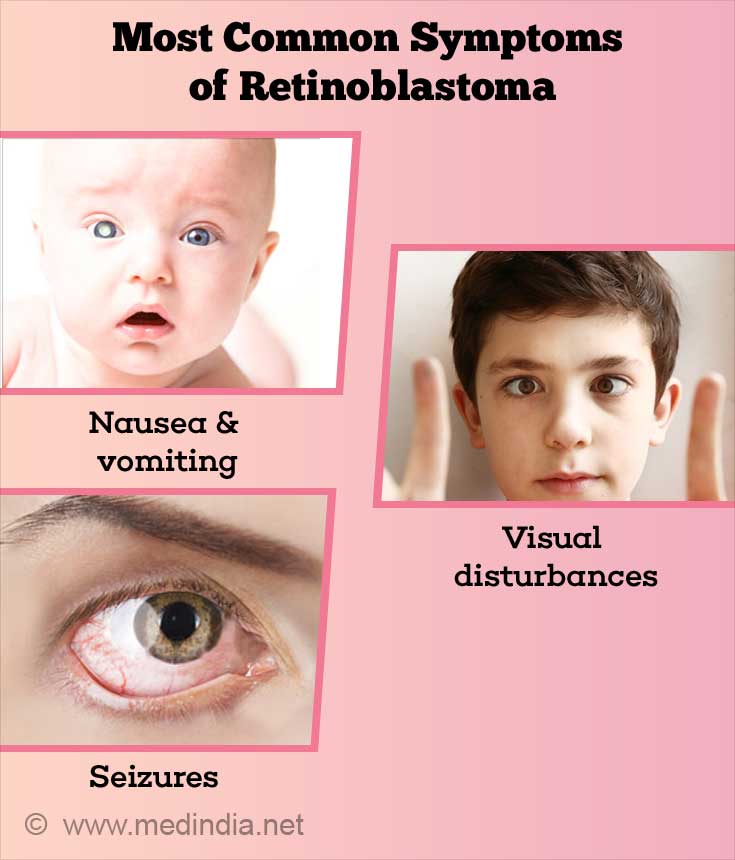 Retinoblastoma Causes Symptoms Diagnosis Treatment And Prevention