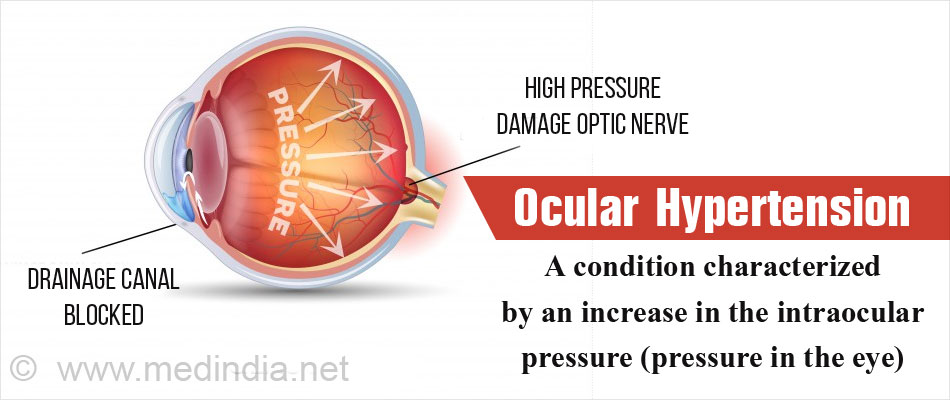 ocular-hypertension-causes-symptoms-diagnosis-treatment-prevention