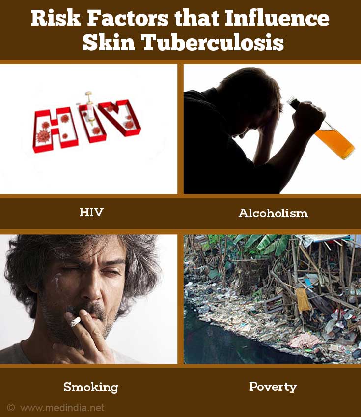 Skin Tuberculosis Causes Symptoms Diagnosis Treatment And Prevention