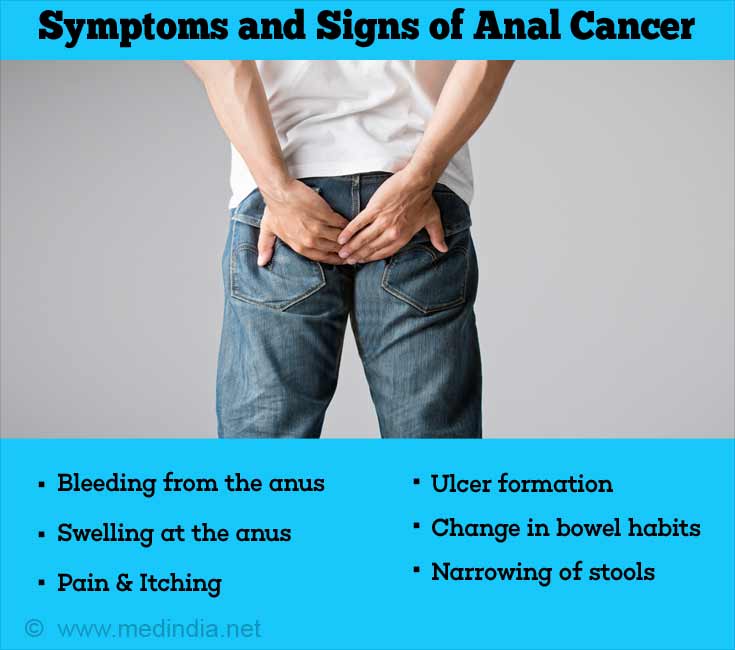Anal Cancer Symptoms Causes Treatment Preventions Symptom Clinic My