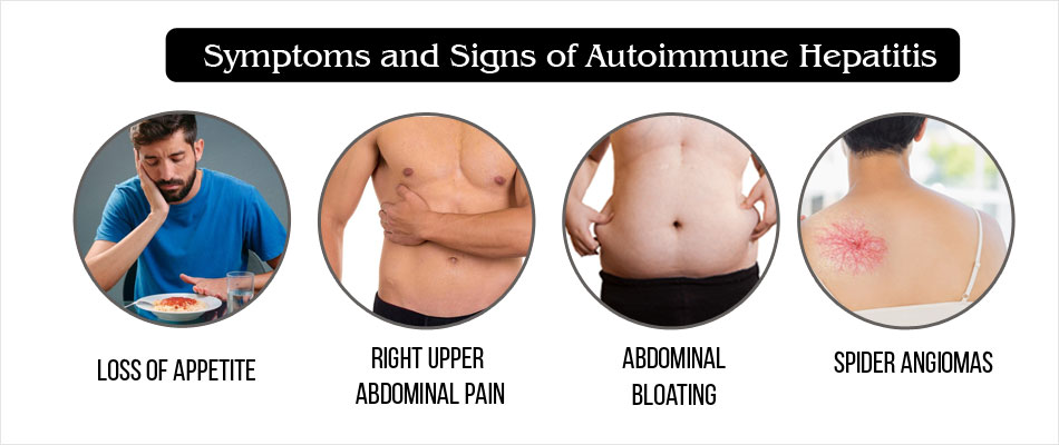 Autoimmune Hepatitis Causes Types Symptoms Complications