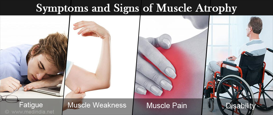 Muscle Atrophy Meaning In English