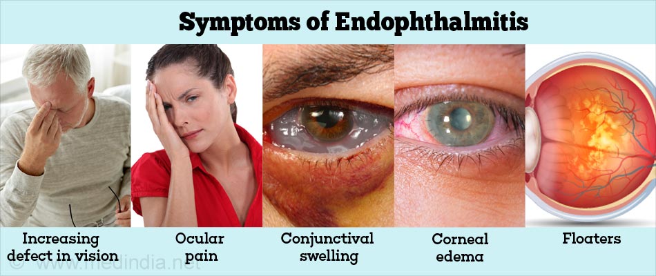 Endophthalmitis - Causes, Symptoms, Diagnosis, Treatment & Prevention