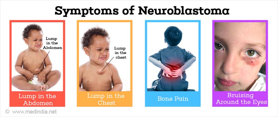 Neuroblastoma - Causes, Symptoms, Diagnosis & Treatment