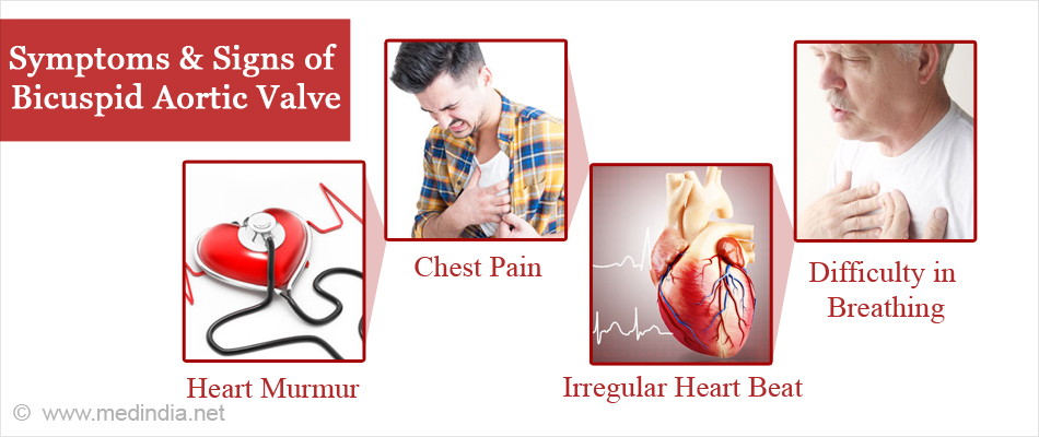 bicuspid-aortic-valve-causes-symptoms-complications-diagnosis