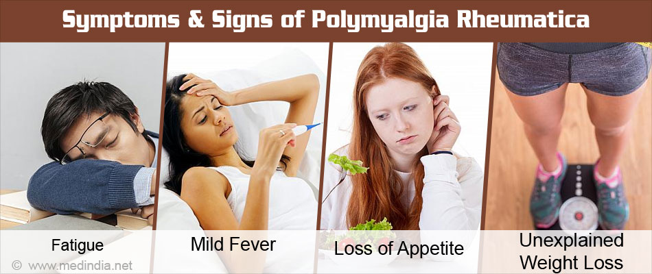 Polymyalgia Rheumatica Causes Symptoms Diagnosis Treatment And Prevention 2435