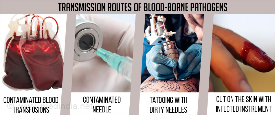 Blood Borne Diseases Transmission Types Diagnosis Prevention