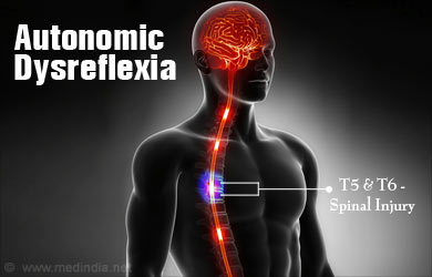 Autonomic Dysreflexia - Causes, Symptoms, Diagnosis, Treatment, Prevention