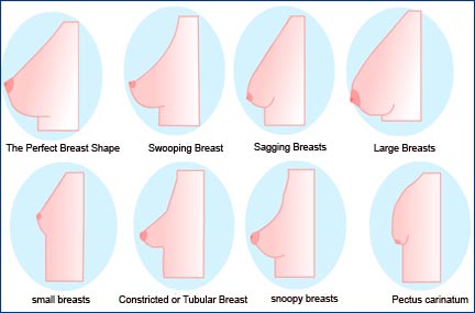 Breast Abnormalities Pictures
