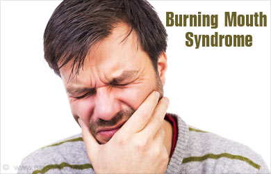 Burning Mouth Syndrome - Causes, Symptoms, Diagnosis, Treatment, Prevention