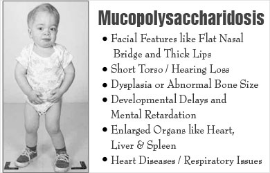 Mucopolysaccharidosis | Inborn Metabolic Diseases - Types, Symptoms ...