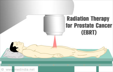 radiation prostate therapy cancer external beam radiotherapy types patients main two