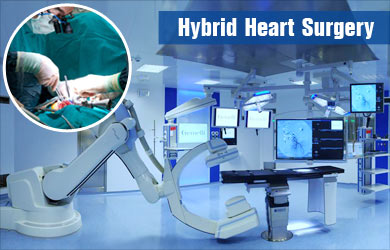 Hybrid Heart Surgery - Requirements, Advantages, Disadvantages