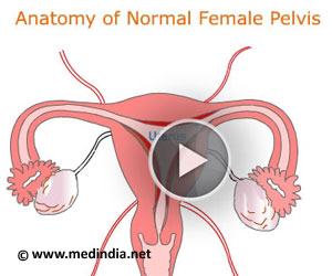 Endometriosis