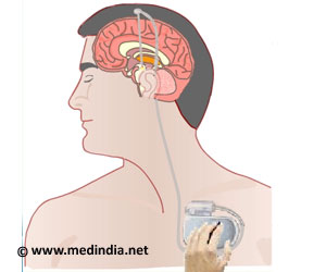 Parkinson's Disease - Surgical Treatment