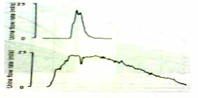 peak flow rate or Q max