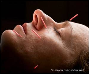 Can Acupuncture Cure Hot Flushes in Menopausal Women?