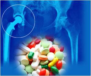  Modern Pharmacologic Treatments Led to a Decrease in Total Hip Replacement Surgeries