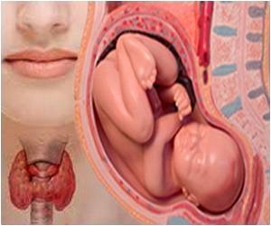  Thyroid Hormone Level in Mothers Linked With Presentation of Babies During Deliveries