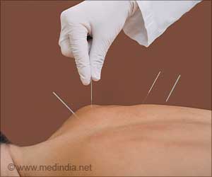 Acupuncture Alleviates Pain and Anxiety in Women Cancer Patients