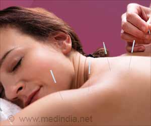 Acupuncture Can Help You Cope With Menopausal Symptoms