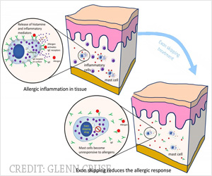 Treatment for Allergic Response by Targeting Mast Cells