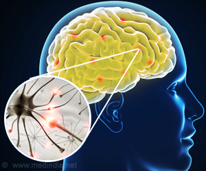 Two Risk Genes for Amyotrophic Lateral Sclerosis Identified
