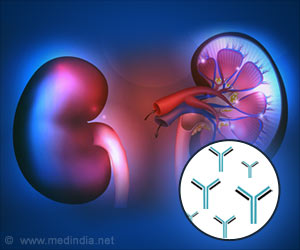 Time of Antibody Response Key to Rejection in Kidney Transplant