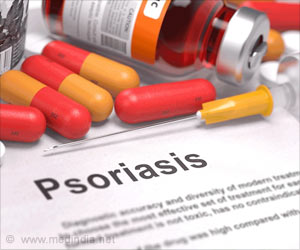 Phase III Clinical Trial Shows Promising Results of Antibody Treatment in Psoriasis