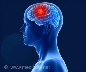 Annual Scans Unnecessary for a Common Type of Benign Brain Tumor 
