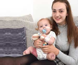 Baby Loses All Four Limbs to Throat Infection That Turned to Sepsis