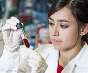 New Biomarker Detects Heart Disease Risk in Lupus Patients
