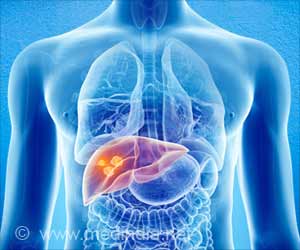 Blood Transfusion During Liver Cancer Surgery May Lead to Recurrence of Cancer and Death