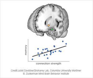 Two Brain Regions are Associated With Learning Circuit in Adolescents