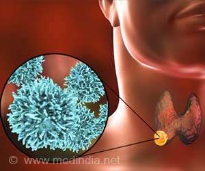 Cabozantinib may Treat Resistant Form of Thyroid Cancer
