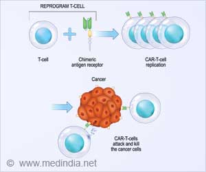 CAR T-Cell Therapy: FDA Warning on Secondary Cancer Risks