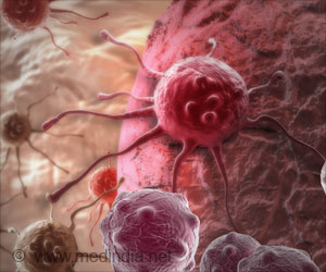  Myeloid Leukemia Can Now be Put To Stop by Blocking Its Growth Factor
