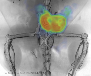 Prostate Cancer Treatment Using New Imaging Technique